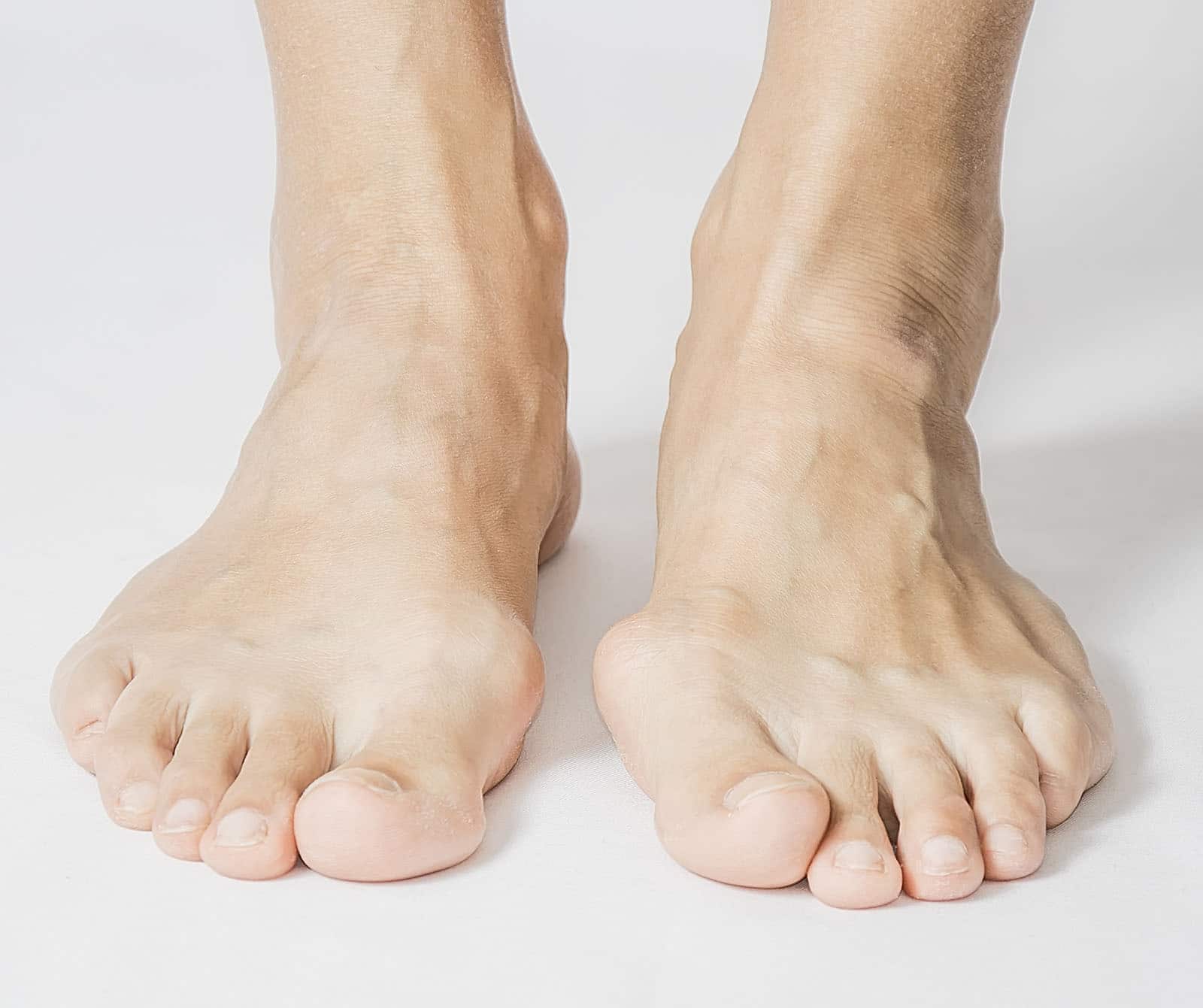 Best Toe Deformities Treatment | Premier Podiatry & Orthopedics ...