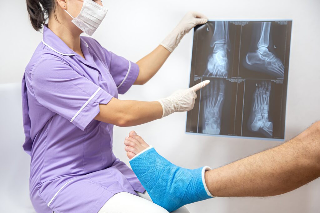 Subchondral Stabilization - Bone fracture foot and leg on male patient being examined by a woman doctor in a hospital.