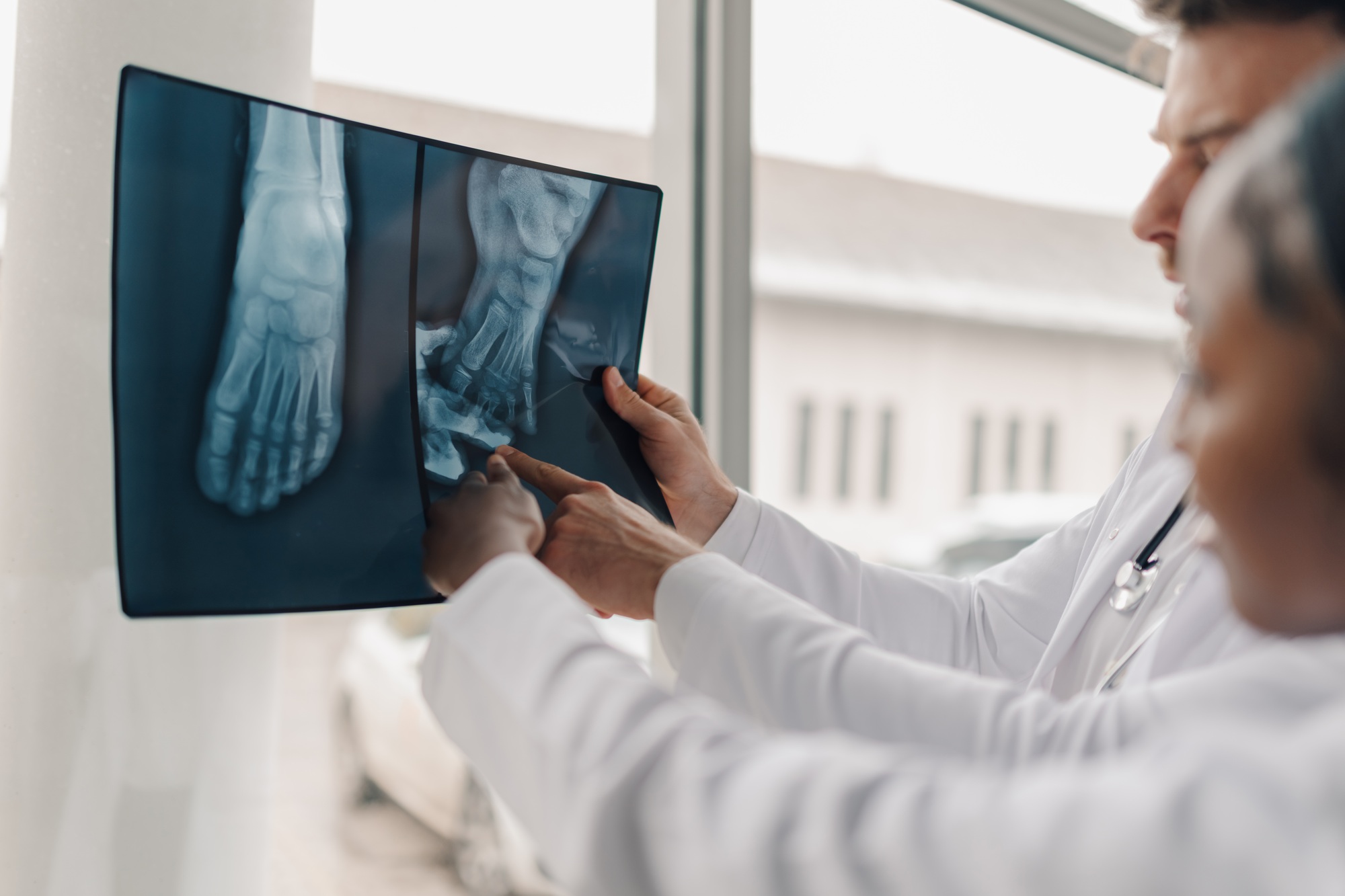 Sesamoid Injuries | Definition and Treatment Options