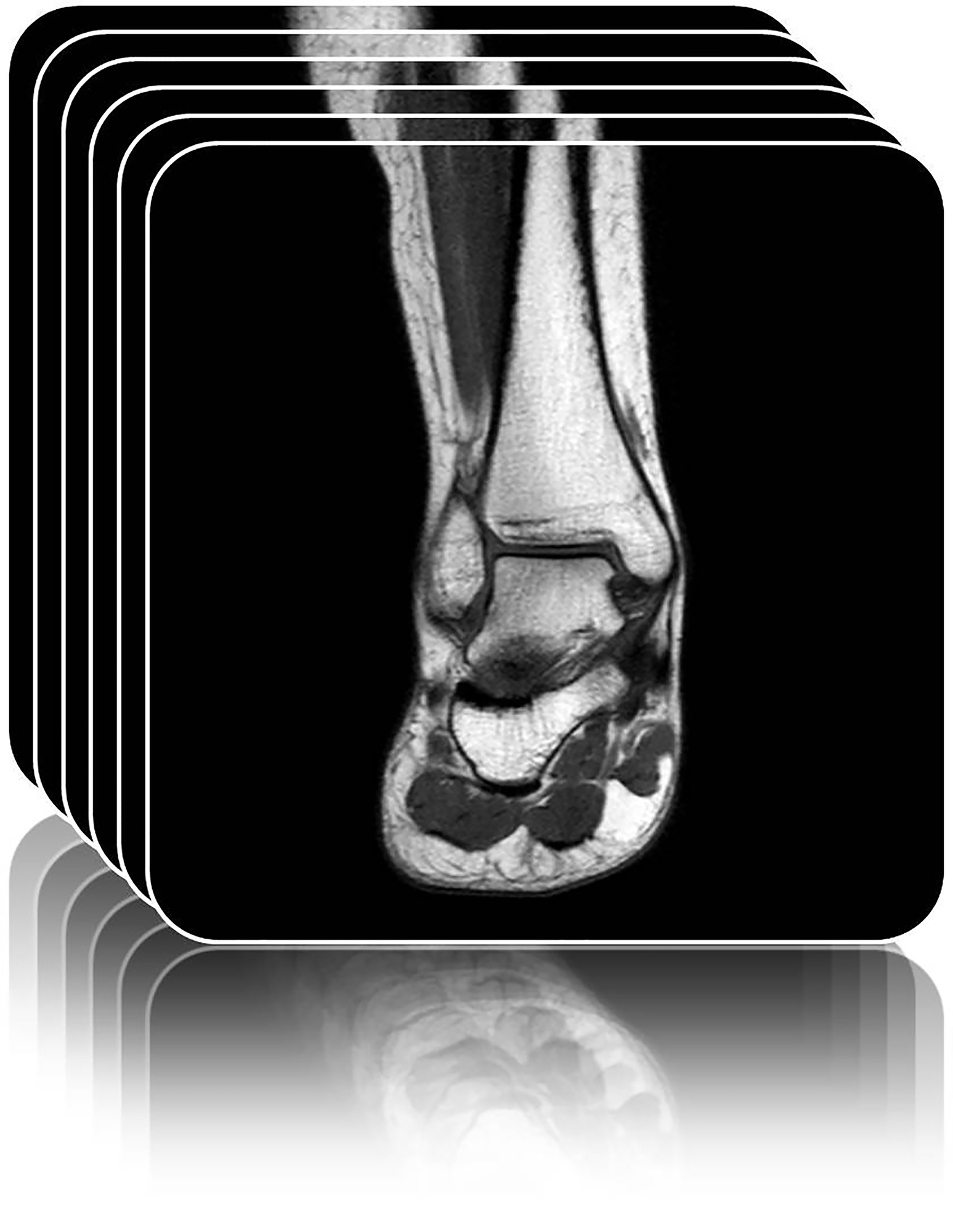 Magnetic Resonance Imaging (MRI) - MRI of the foot and ankle