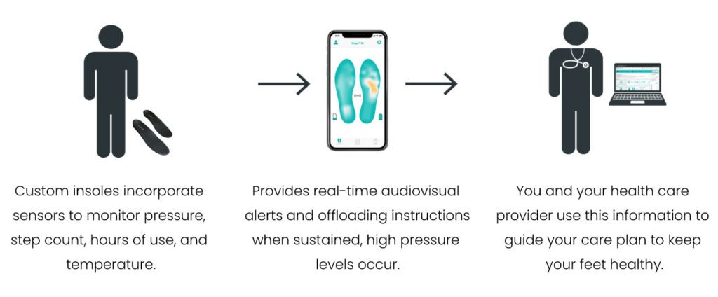 Orpyx® SI Sensory Insoles