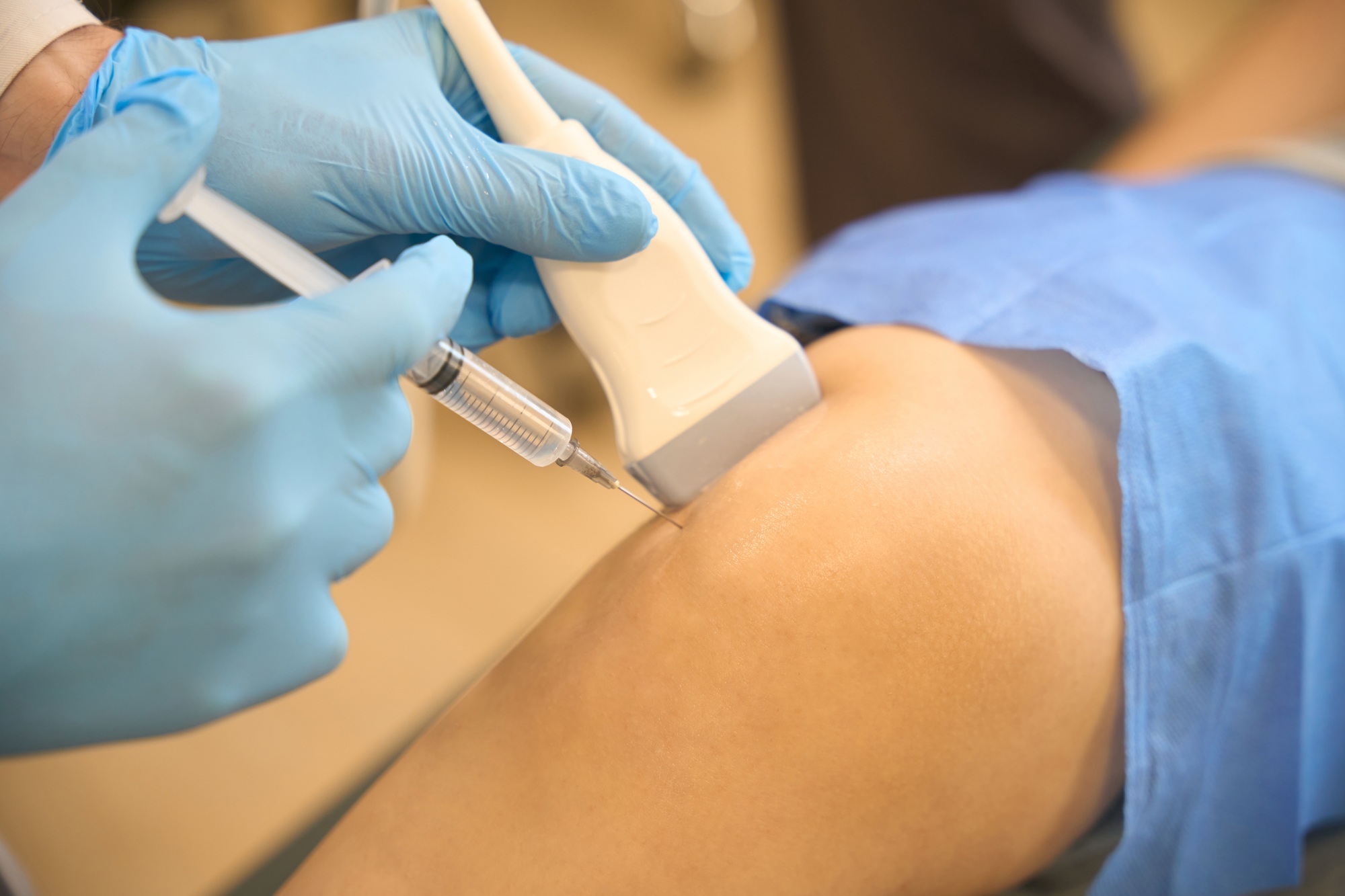 Ultrasound-Guided Injections - Surgeon performing ultrasound-guided lower extremity joint aspiration