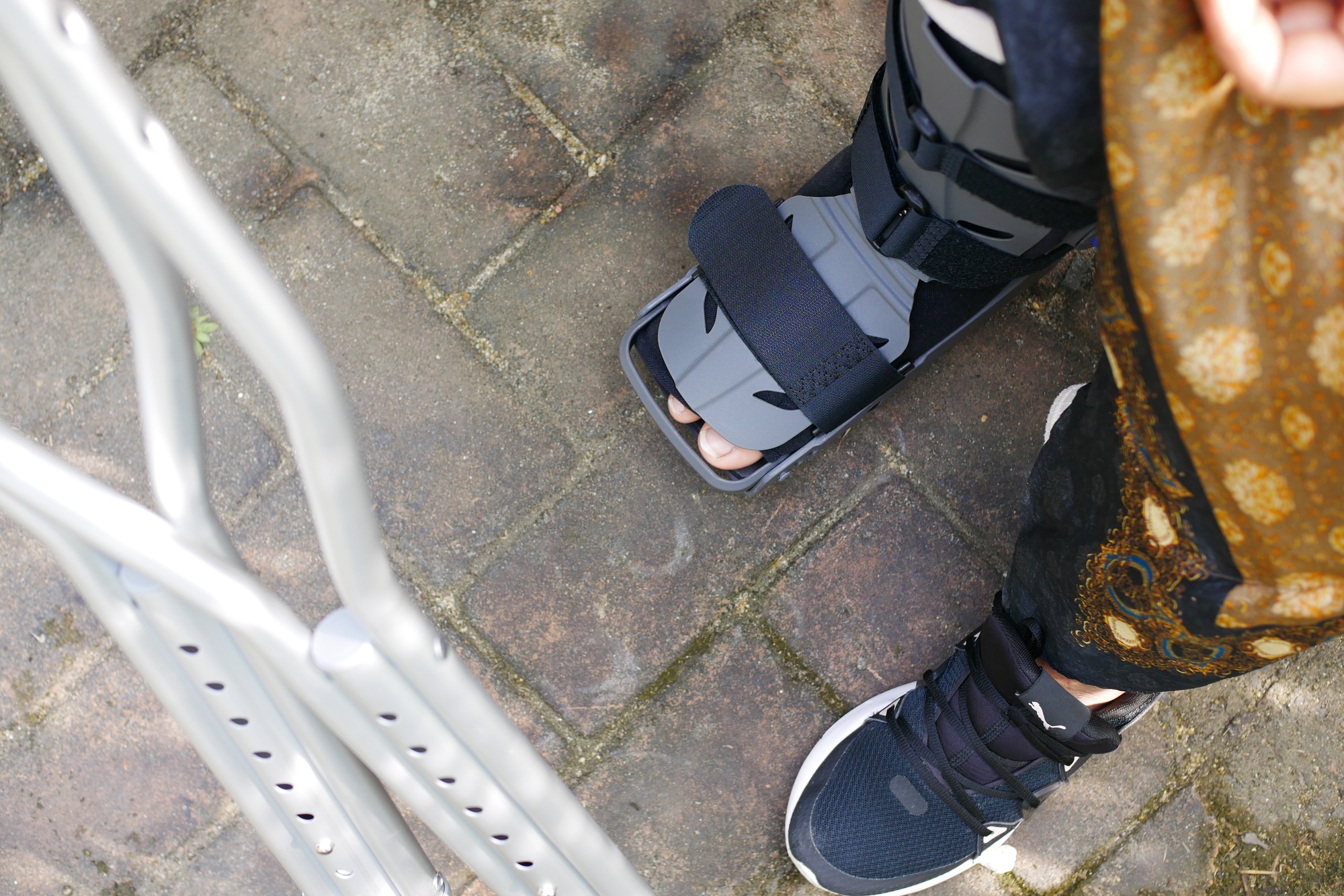 Foot and Ankle Joint Replacements - women broken feet with a grey plastic boot ankle brace injury protecting boot